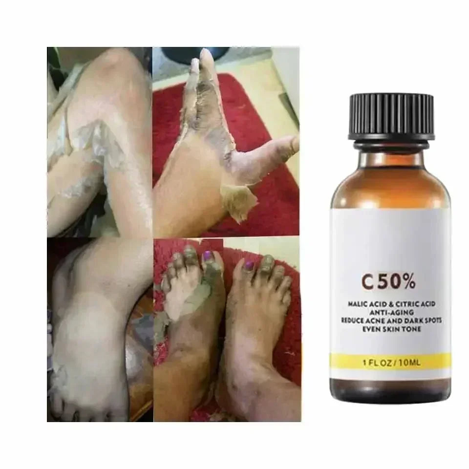 With Malic Acid And Citric Acid For Face Facial Peel 40% Peeling Serum Peeling Serum Chemical Peel Whitening Nourishing Essence