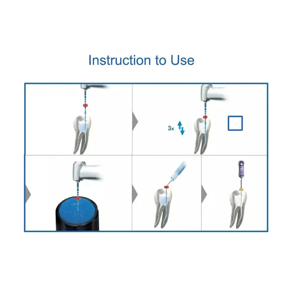 6Pcs/Box Orthdent Dental Reciprocating Blue Endodontic Files Only One Engine Use Heat Activated 21/25/31mm Dentistry Instrument
